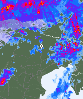 Radar
