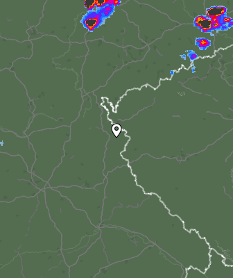 Radar