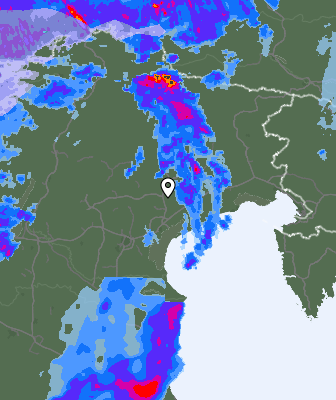 Radar
