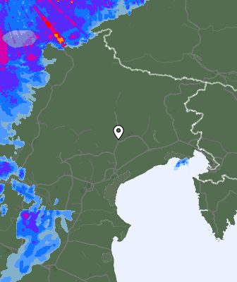 Radar