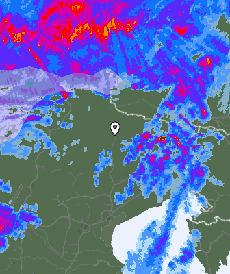 Radar