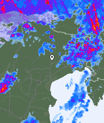 Radar