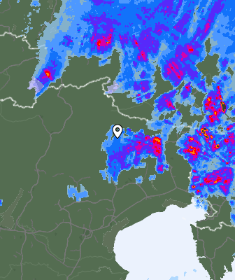 Radar