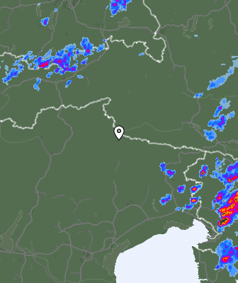 Radar