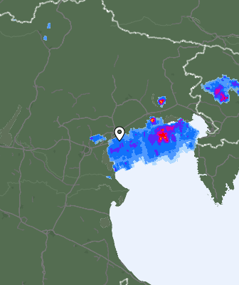Radar