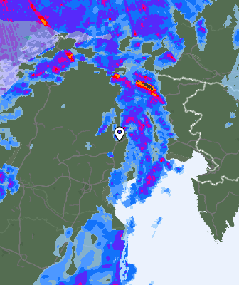 Radar