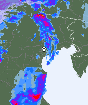 Radar