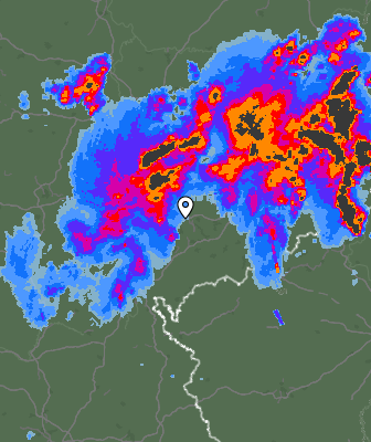 Radar