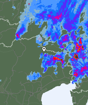 Radar
