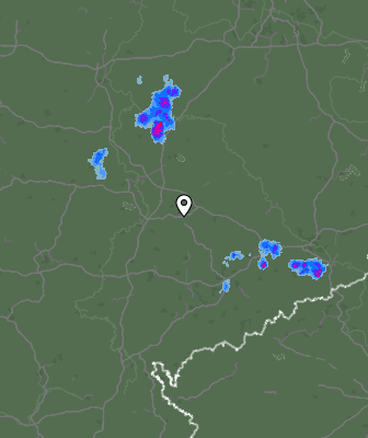 Radar
