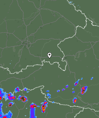 Radar
