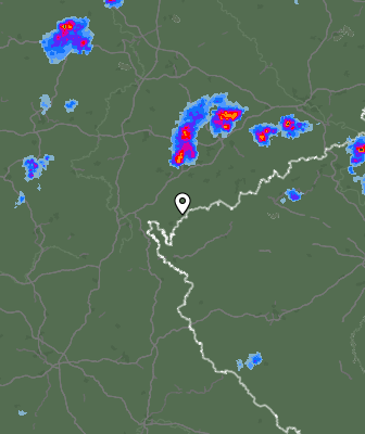 Radar