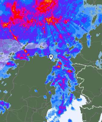 Radar
