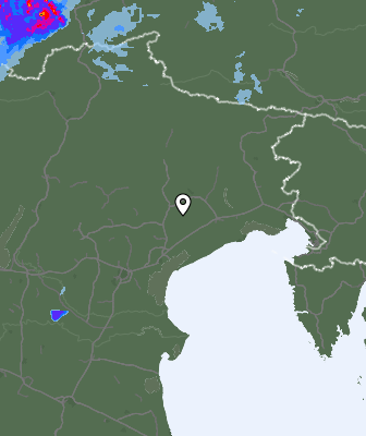 Radar
