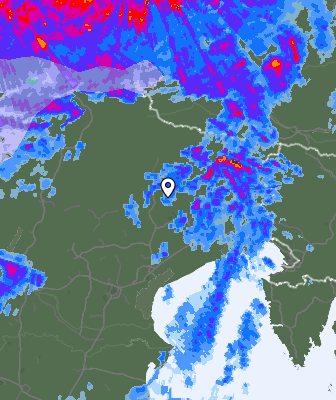 Radar