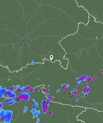 Radar