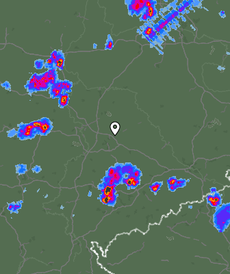 Radar