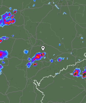 Radar