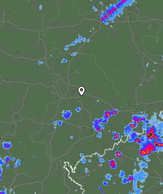Radar