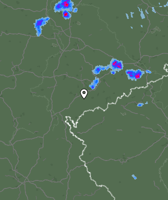 Radar