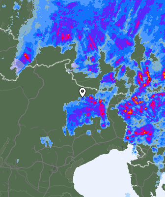 Radar