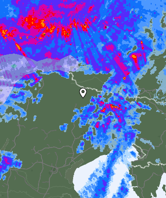 Radar