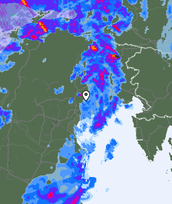 Radar