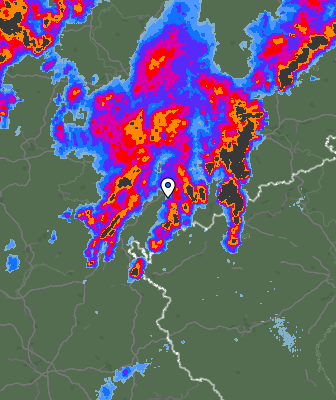 Radar