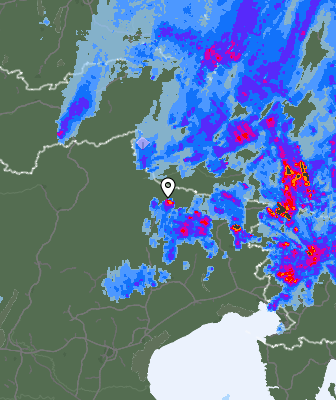 Radar