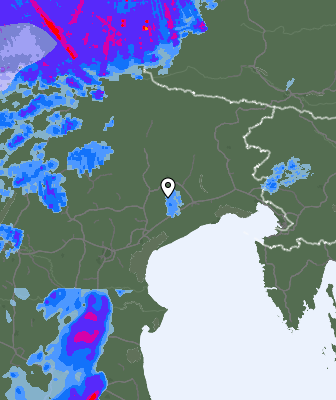 Radar