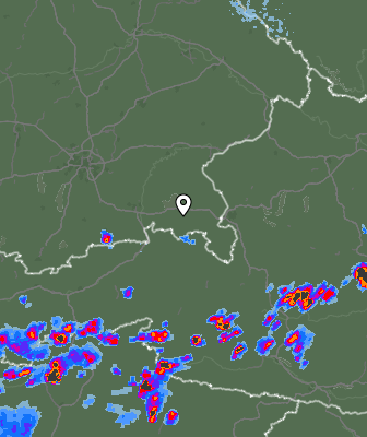 Radar