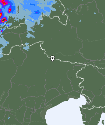 Radar