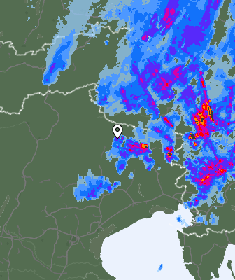 Radar