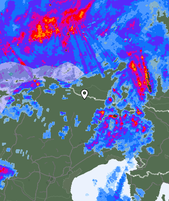 Radar