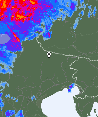 Radar