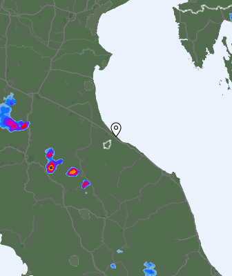 Radar