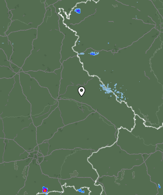 Radar