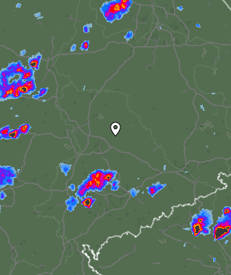 Radar
