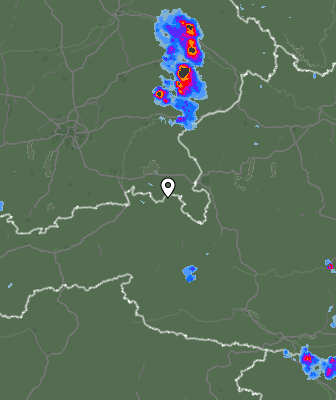 Radar