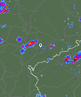 Radar
