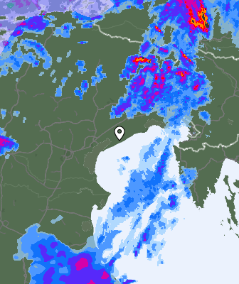 Radar