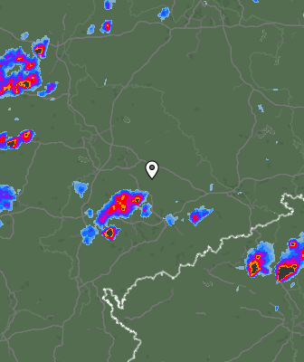 Radar