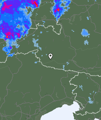 Radar