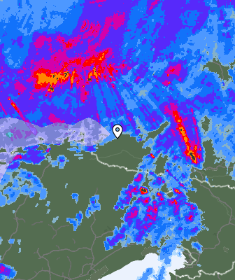 Radar