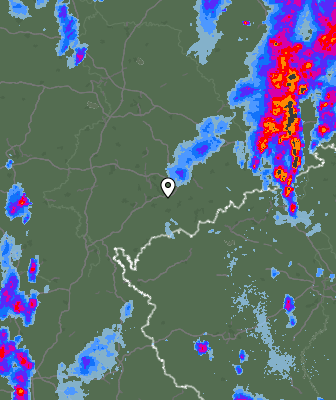 Radar