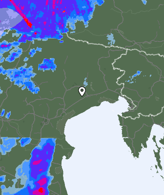 Radar