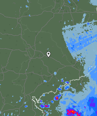 Radar