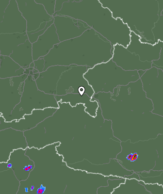 Radar