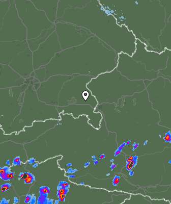 Radar