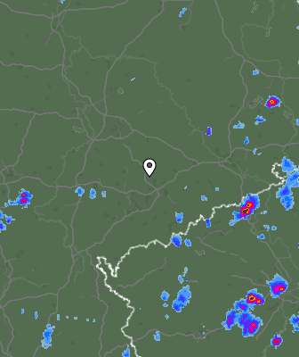 Radar